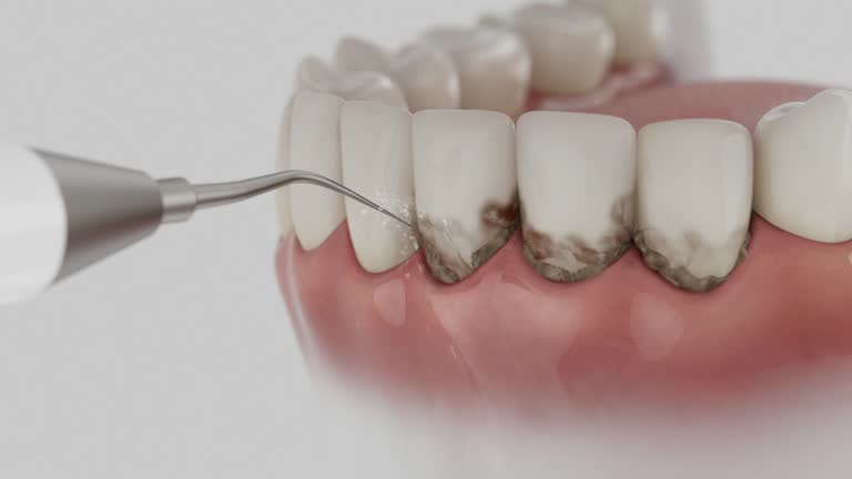 Reliable Dental Implants contractor in Spring City, UT by Smile Center Dentistry